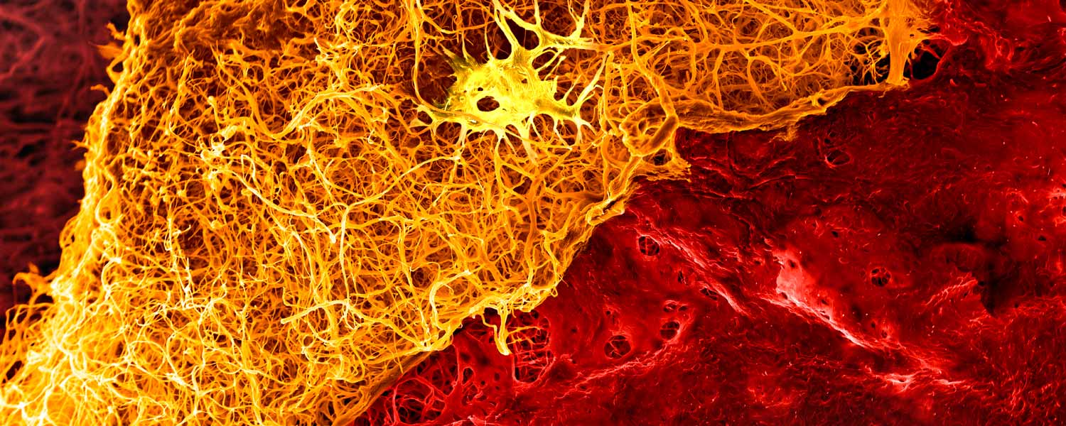 Elektronen Raster Mikroskoph Foto